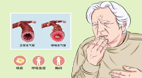 怎么判断是不是哮喘？